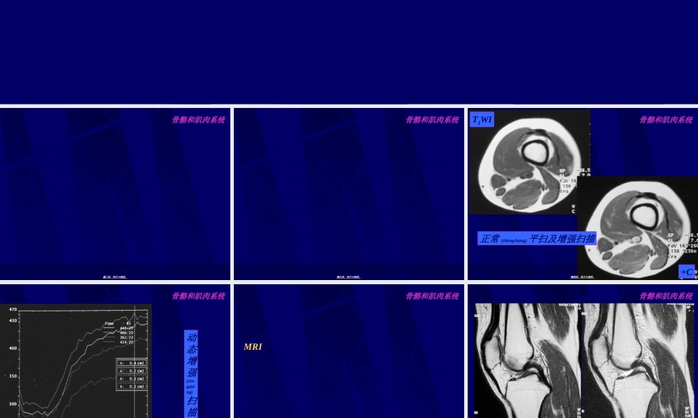 2022年医学专题—MRI骨骼和肌肉系统-影像FTP(1).ppt