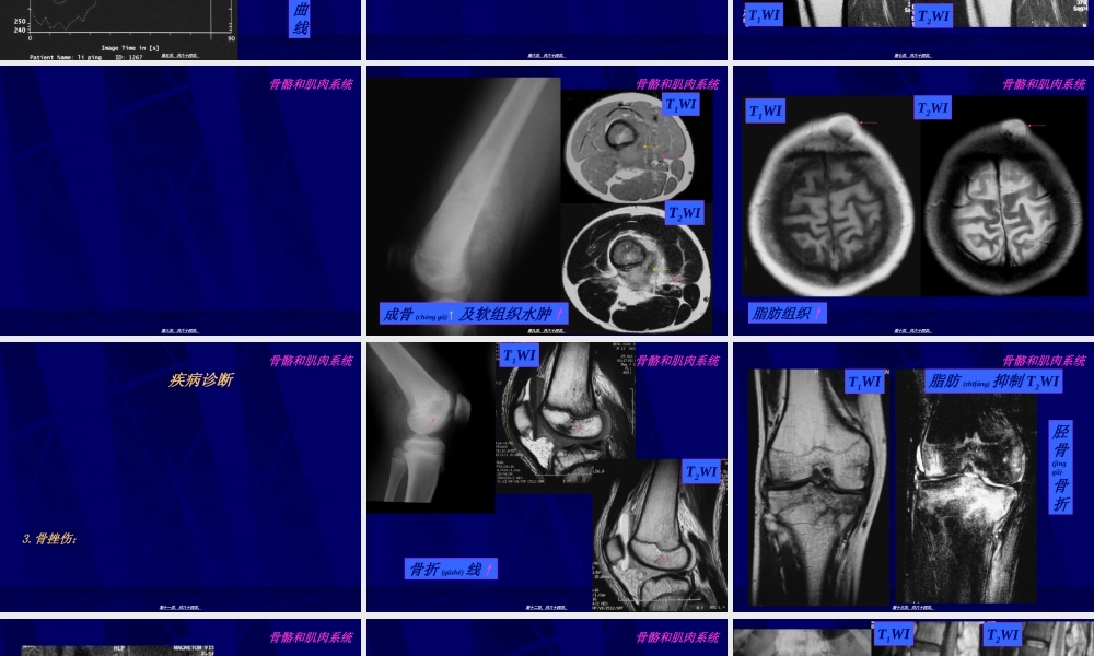 2022年医学专题—MRI骨骼和肌肉系统-影像FTP(1).ppt