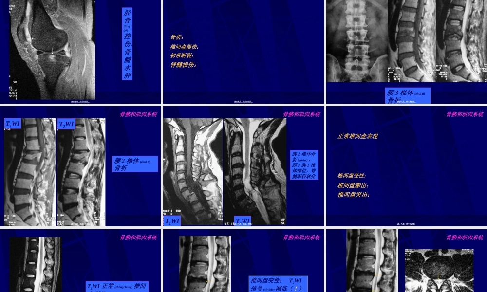 2022年医学专题—MRI骨骼和肌肉系统-影像FTP(1).ppt