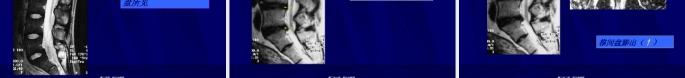 2022年医学专题—MRI骨骼和肌肉系统-影像FTP(1).ppt