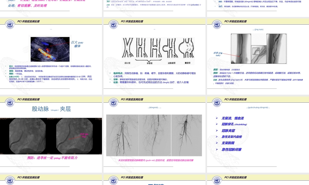 2022年医学专题—PCI的常见并发症的防治(1).ppt