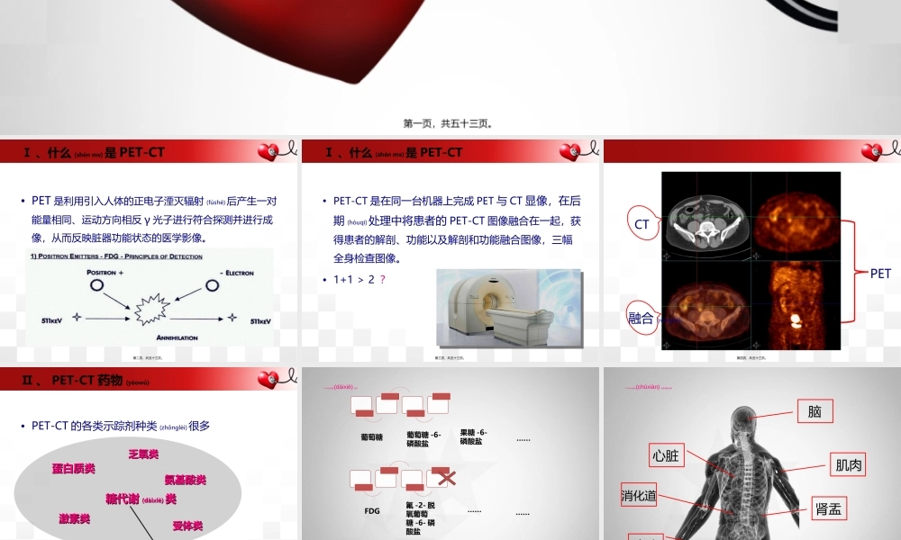 2022年医学专题—PET-CT在消化系统应用(1).ppt