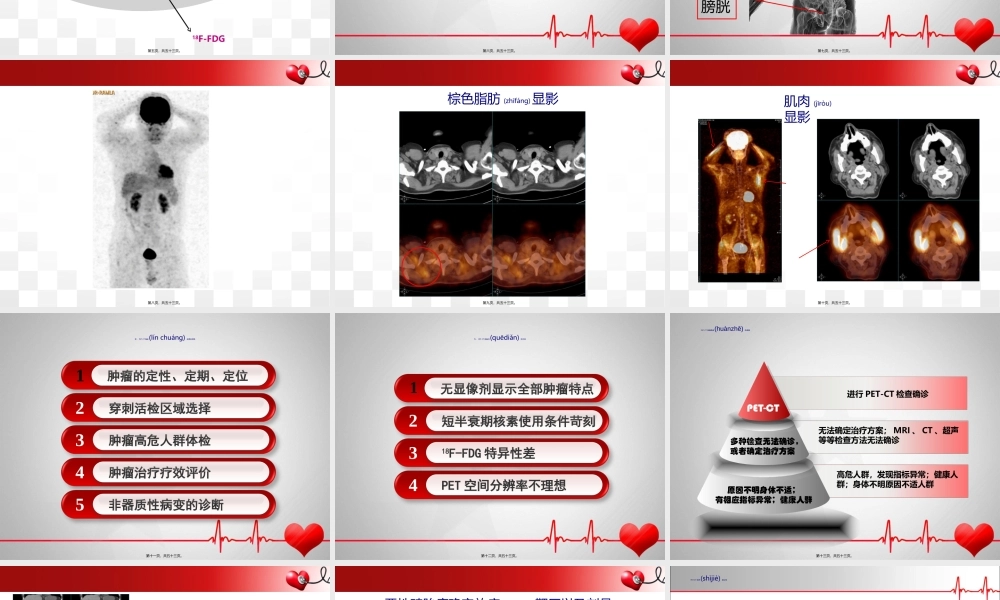 2022年医学专题—PET-CT在消化系统应用(1).ppt