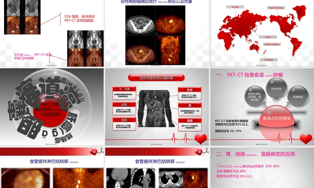 2022年医学专题—PET-CT在消化系统应用(1).ppt