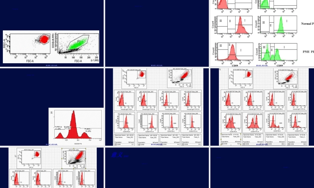 2022年医学专题—PNH-阵发性睡眠性血红蛋白尿的流式细胞术检测解读(1).ppt