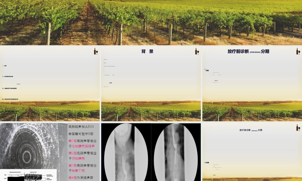 2022年医学专题—PET-CT在食管癌放疗中的进展(1).ppt