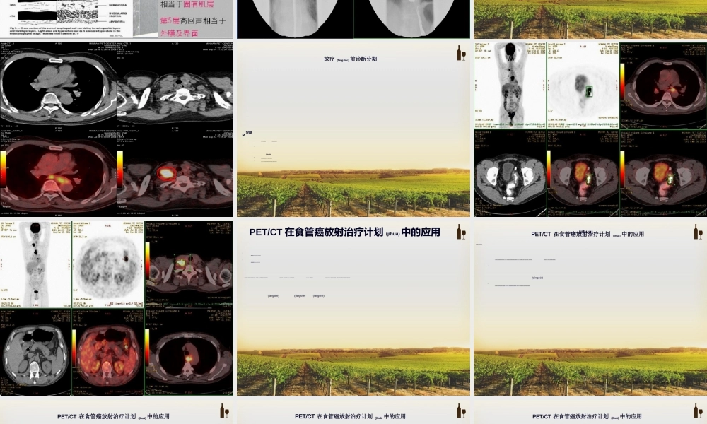 2022年医学专题—PET-CT在食管癌放疗中的进展(1).ppt