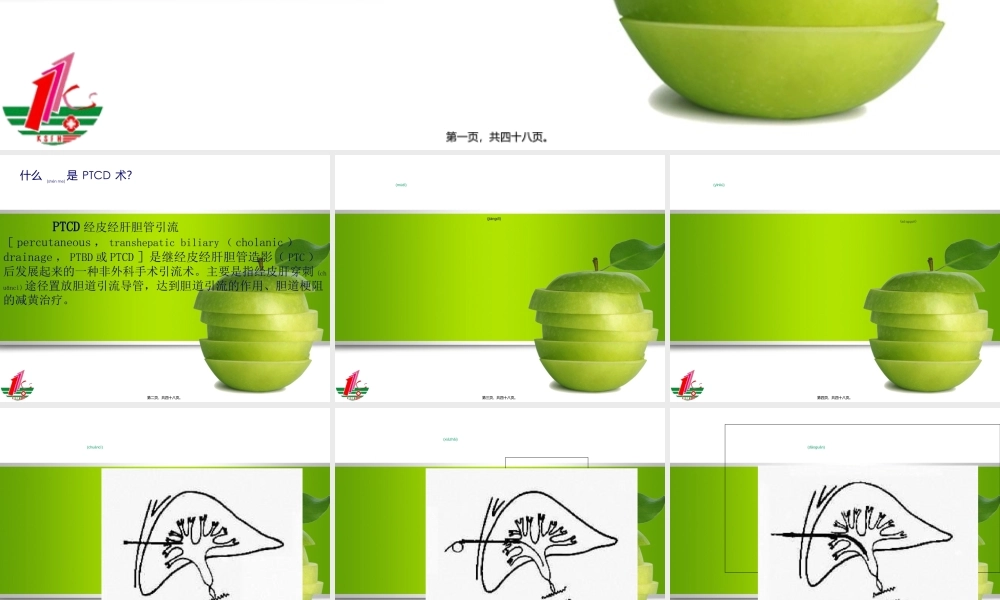 2022年医学专题—ptcd术(1).ppt