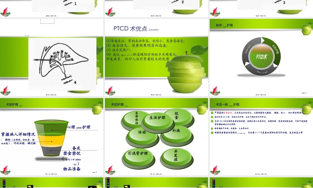 2022年医学专题—ptcd术(1).ppt