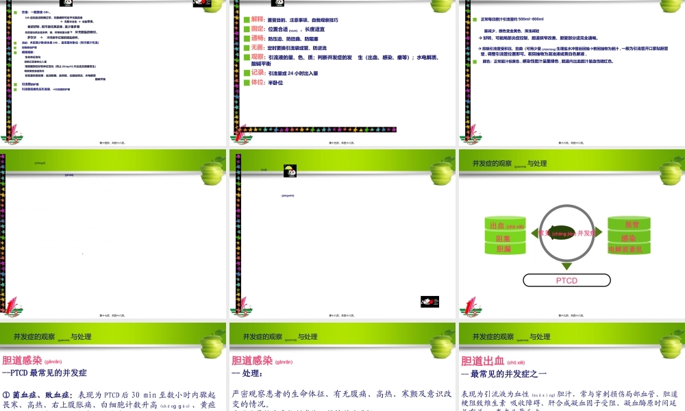 2022年医学专题—ptcd术(1).ppt