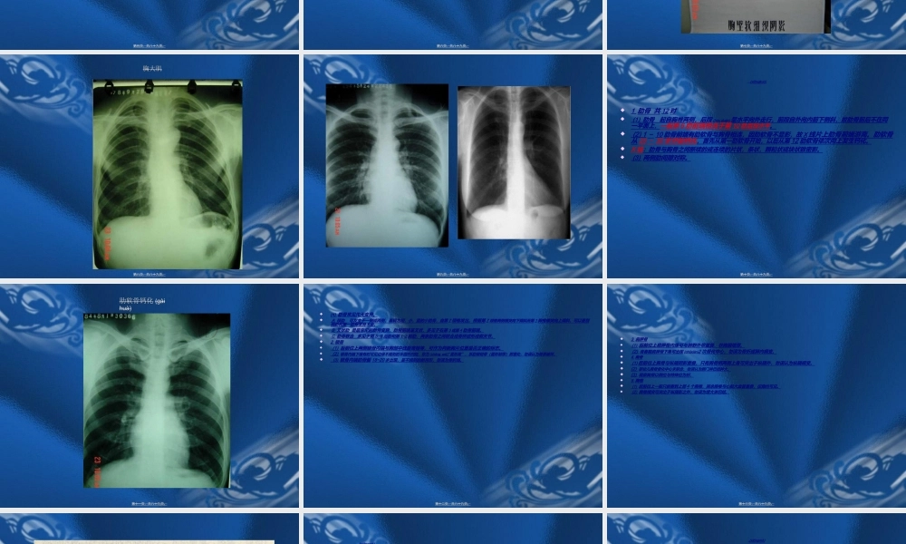 2022年医学专题—x线正常及基本病变(1).ppt
