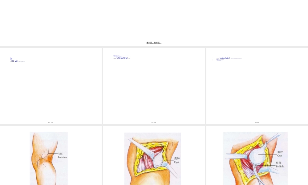 2022年医学专题—[精品]胭窝囊肿除术(1).ppt