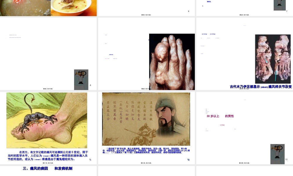 2022年医学专题—、痛风(1).ppt