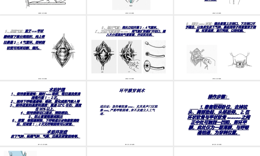 2022年医学专题—【印刷】气管切开术环甲膜穿刺术(1).ppt