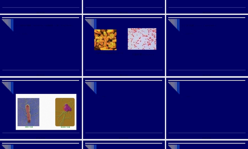 2022年医学专题—七、食品中常见的细菌(1).ppt