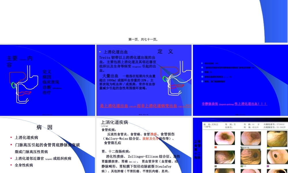 2022年医学专题—上消化道出血的处理(1).ppt