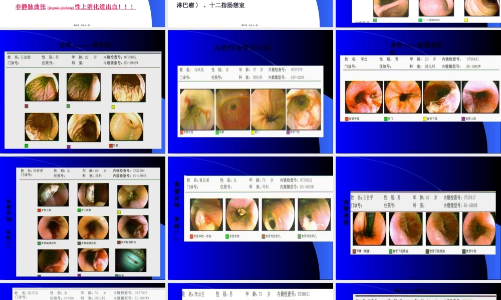 2022年医学专题—上消化道出血的处理(1).ppt