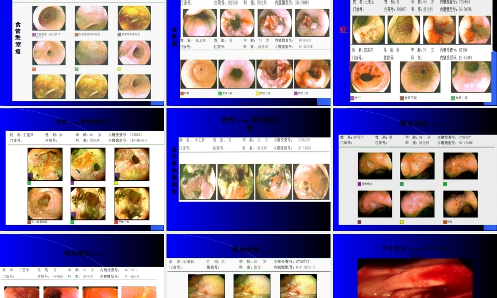 2022年医学专题—上消化道出血的处理(1).ppt