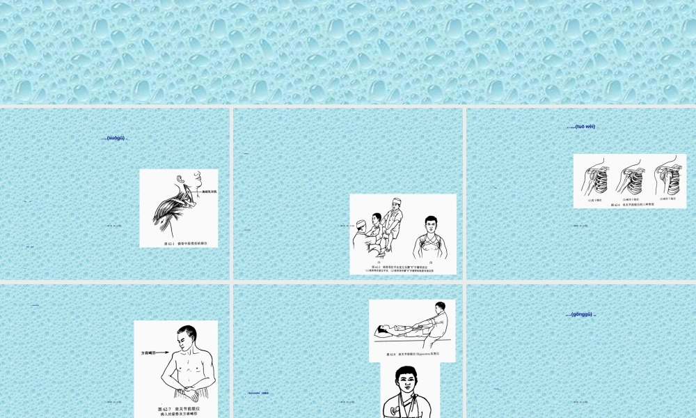 2022年医学专题—上肢骨、关节损伤(1).ppt