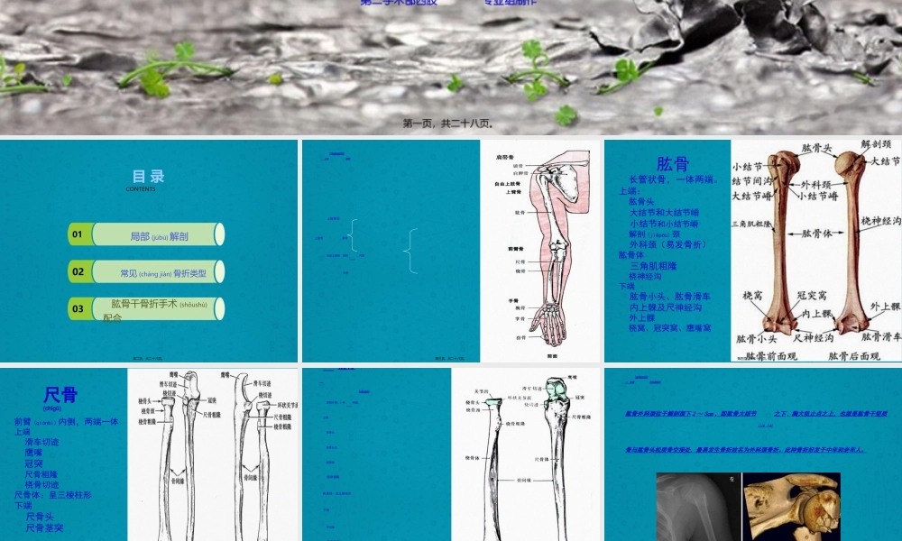2022年医学专题—上肢骨折及手术配合(1).ppt