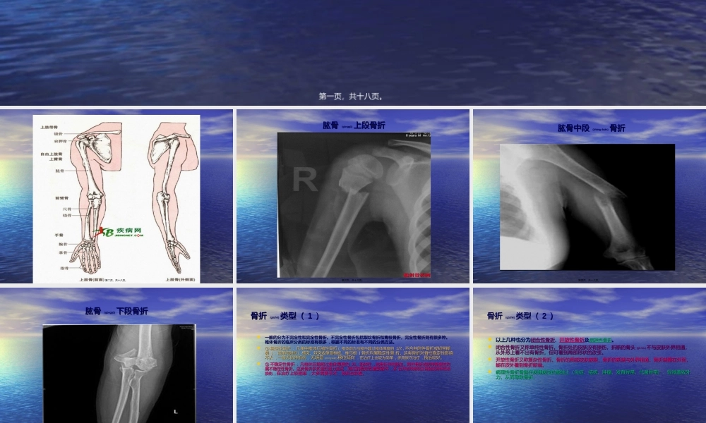 2022年医学专题—上肢骨折术后康复锻炼(1).ppt