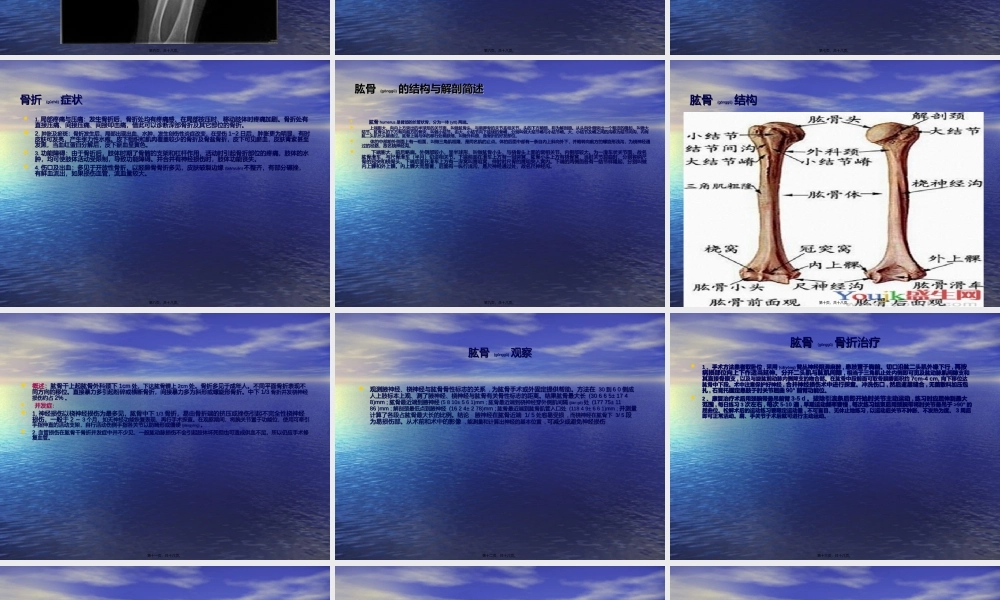 2022年医学专题—上肢骨折术后康复锻炼(1).ppt