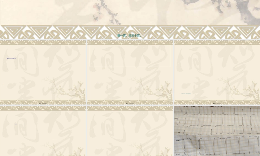 2022年医学专题—不稳定型心绞痛合并甲减1例(1).ppt