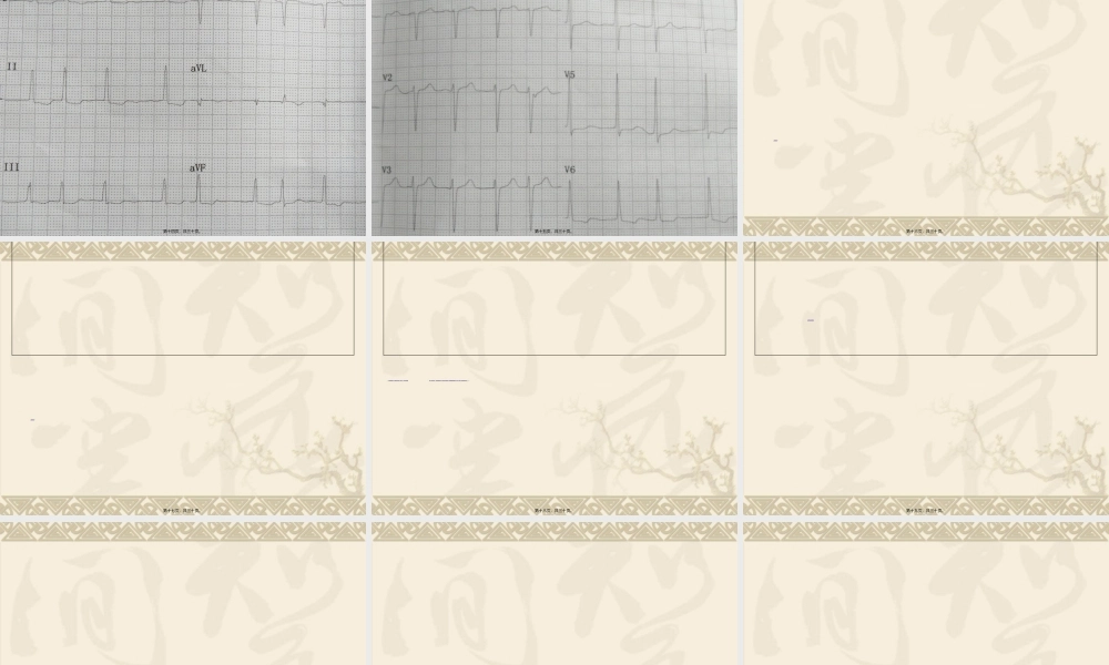 2022年医学专题—不稳定型心绞痛合并甲减1例(1).ppt