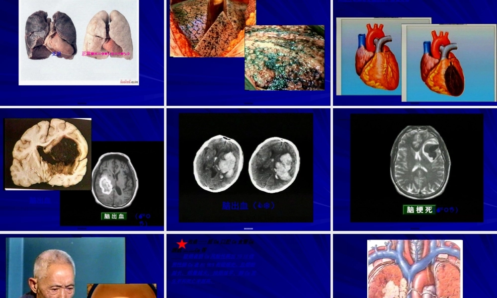 2022年医学专题—不良行为对健康的影响(1).ppt