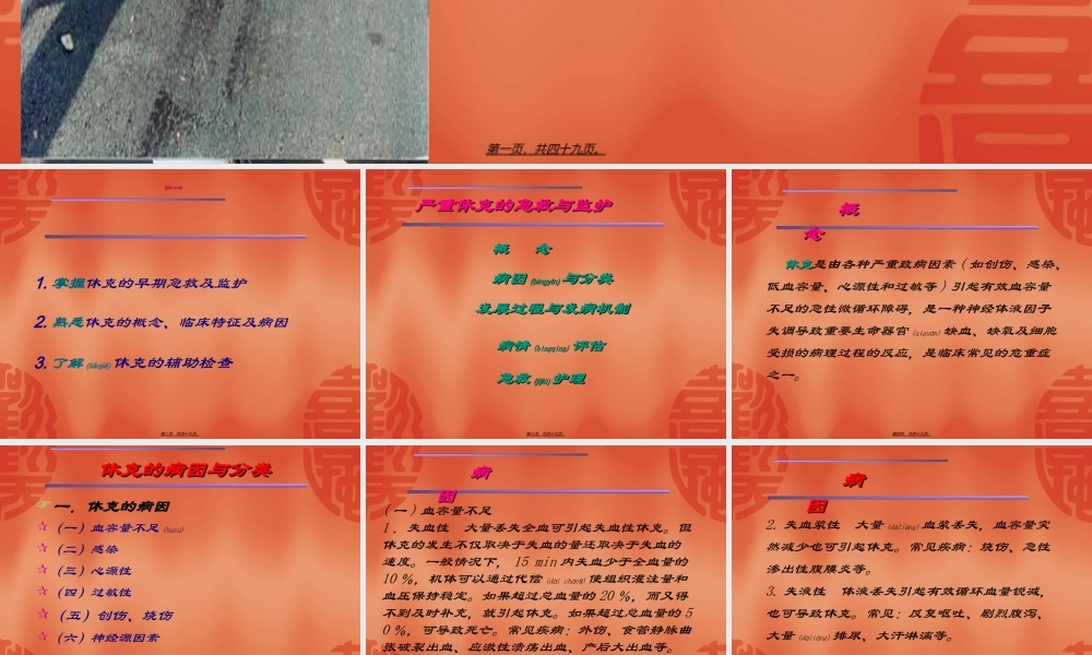 2022年医学专题—严重休克的急救与监护(1).ppt