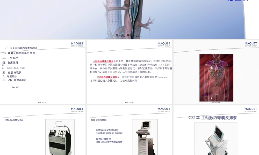 2022年医学专题—主动脉内球囊反搏术1(1).ppt