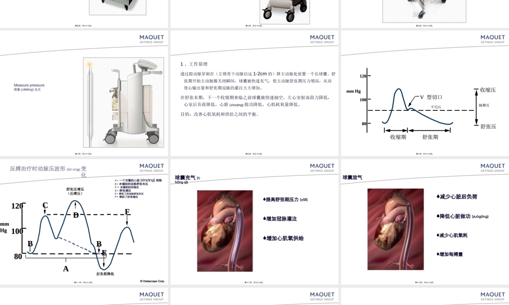 2022年医学专题—主动脉内球囊反搏术1(1).ppt