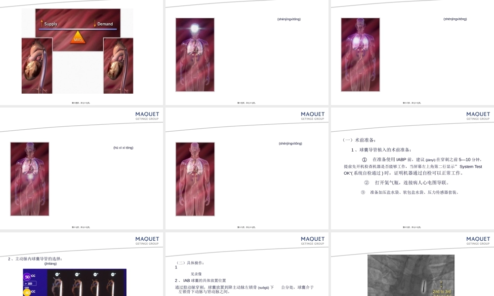 2022年医学专题—主动脉内球囊反搏术1(1).ppt