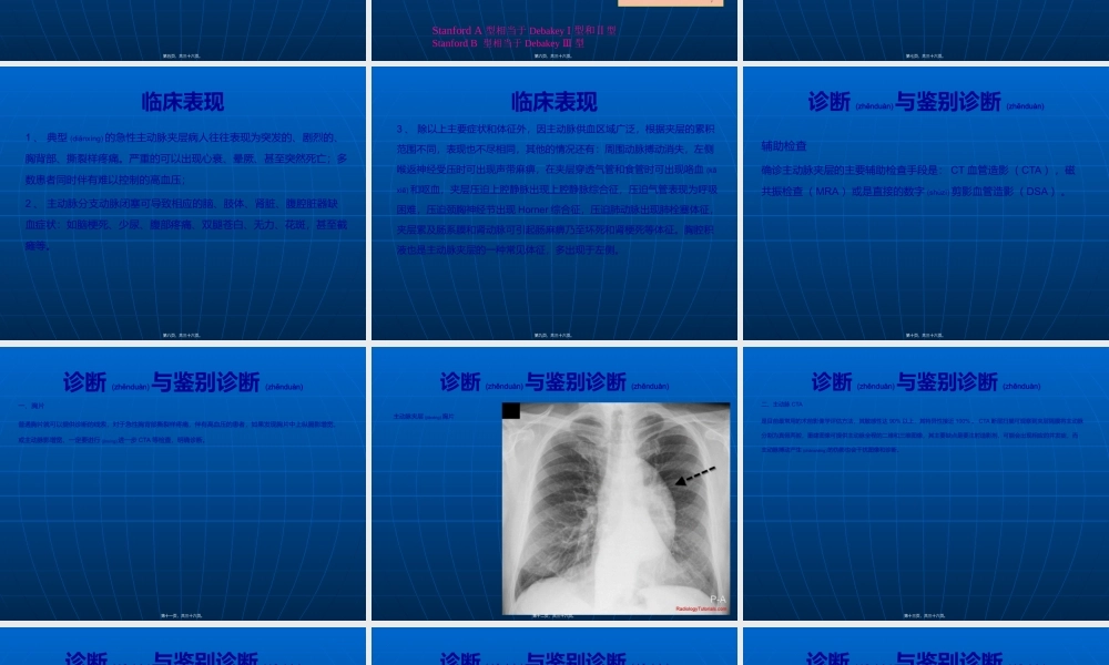 2022年医学专题—主动脉综合征的诊治(1).ppt