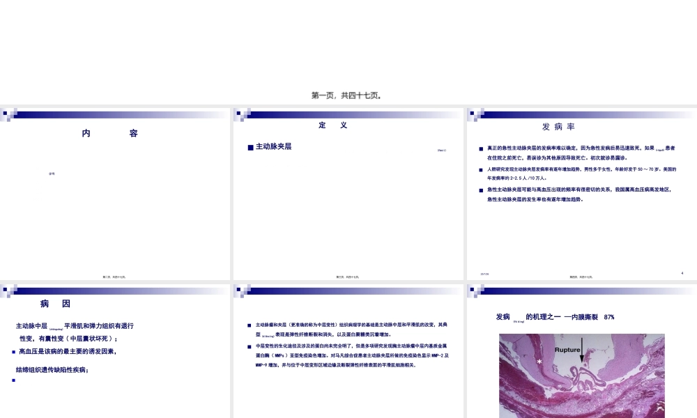 2022年医学专题—主动脉夹层.jsp(1).ppt