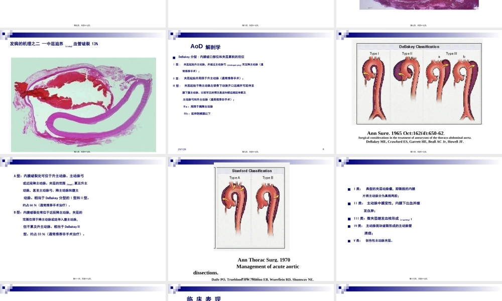2022年医学专题—主动脉夹层.jsp(1).ppt
