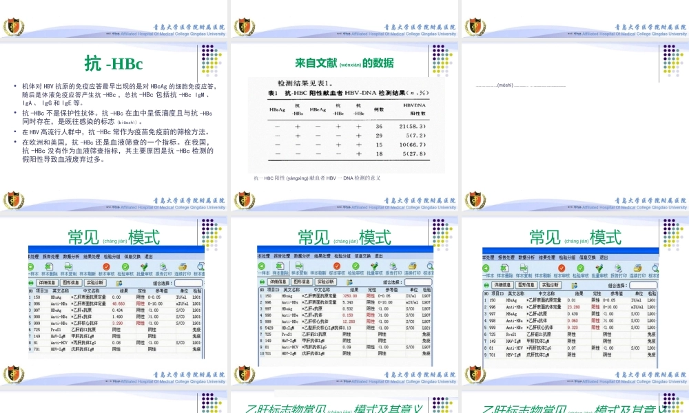 2022年医学专题—乙肝标志物不常见模式分析(1).ppt