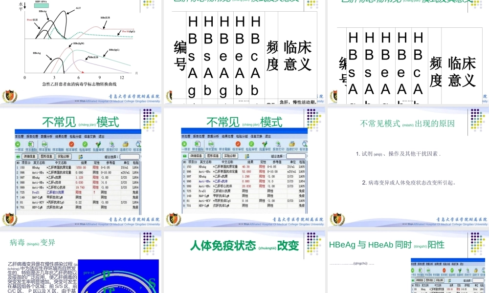 2022年医学专题—乙肝标志物不常见模式分析(1).ppt