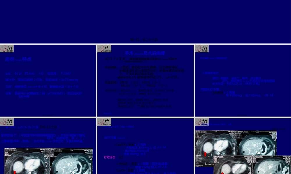 2022年医学专题—乳腺癌典型病例讨论一例(1).pptx