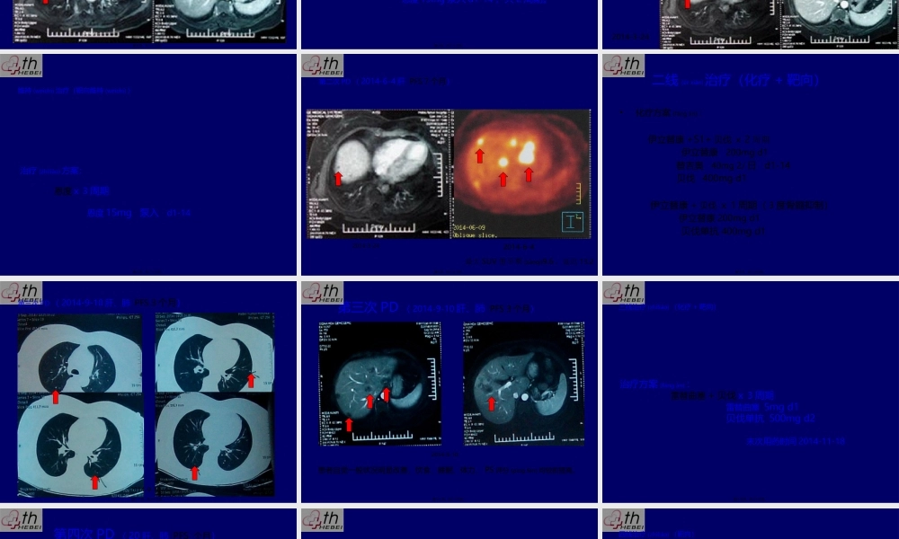 2022年医学专题—乳腺癌典型病例讨论一例(1).pptx