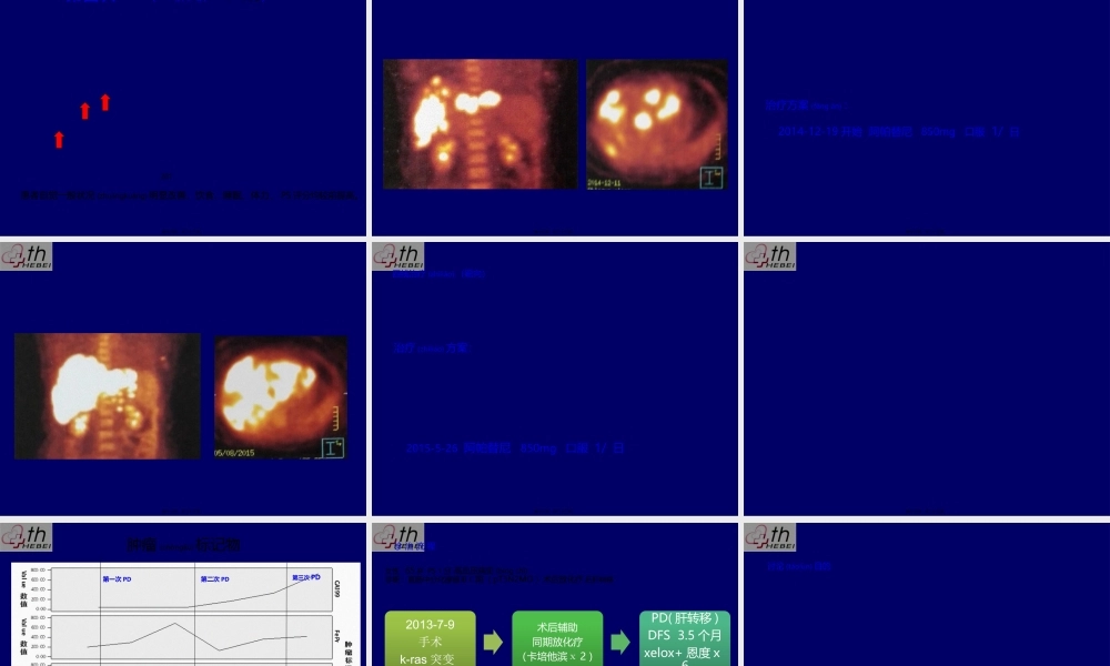 2022年医学专题—乳腺癌典型病例讨论一例(1).pptx