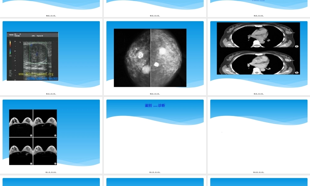 2022年医学专题—乳腺纤维腺瘤(1).ppt