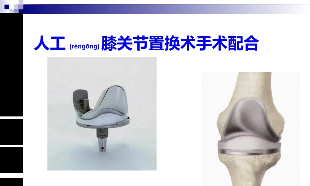 2022年医学专题—人工膝关节置换术手术配合ppt(1).ppt
