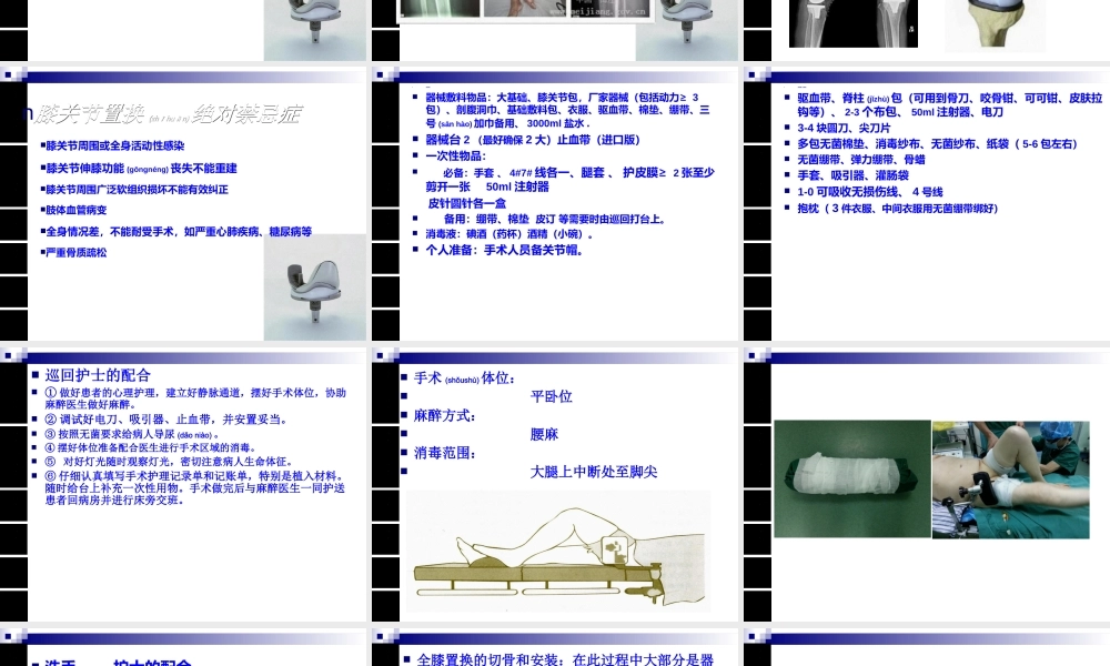 2022年医学专题—人工膝关节置换术手术配合ppt(1).ppt