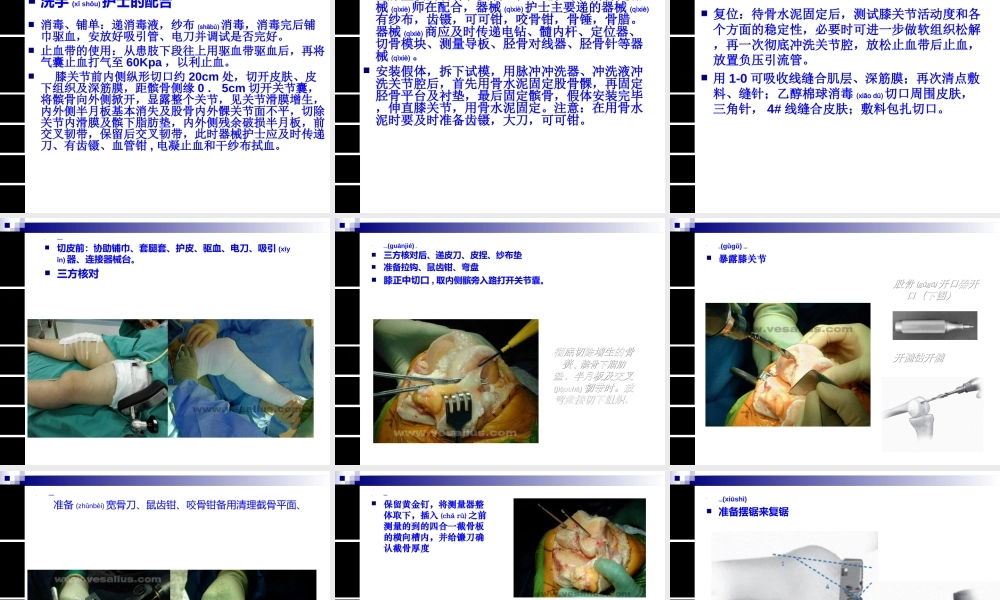 2022年医学专题—人工膝关节置换术手术配合ppt(1).ppt