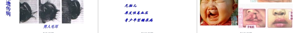 2022年医学专题—人类遗传病的主要类型(1).ppt