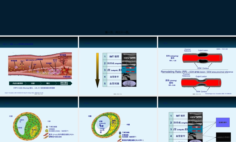 2022年医学专题—他汀在颈动脉粥样硬化中的证据(1).ppt