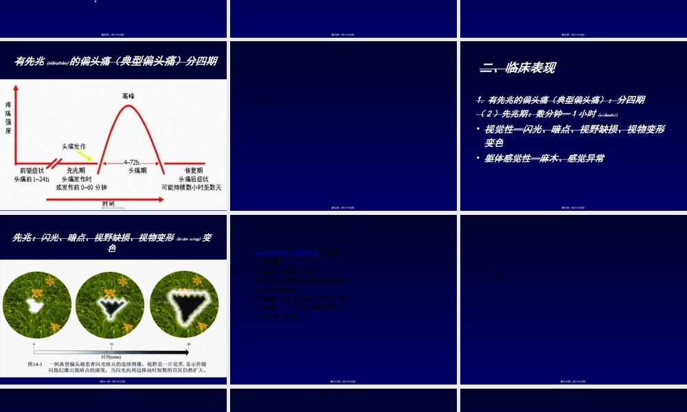 2022年医学专题—偏头痛(1).ppt