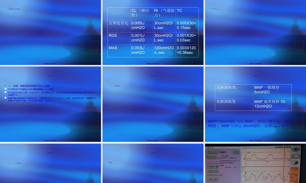 2022年医学专题—儿科呼吸机应用(1).ppt