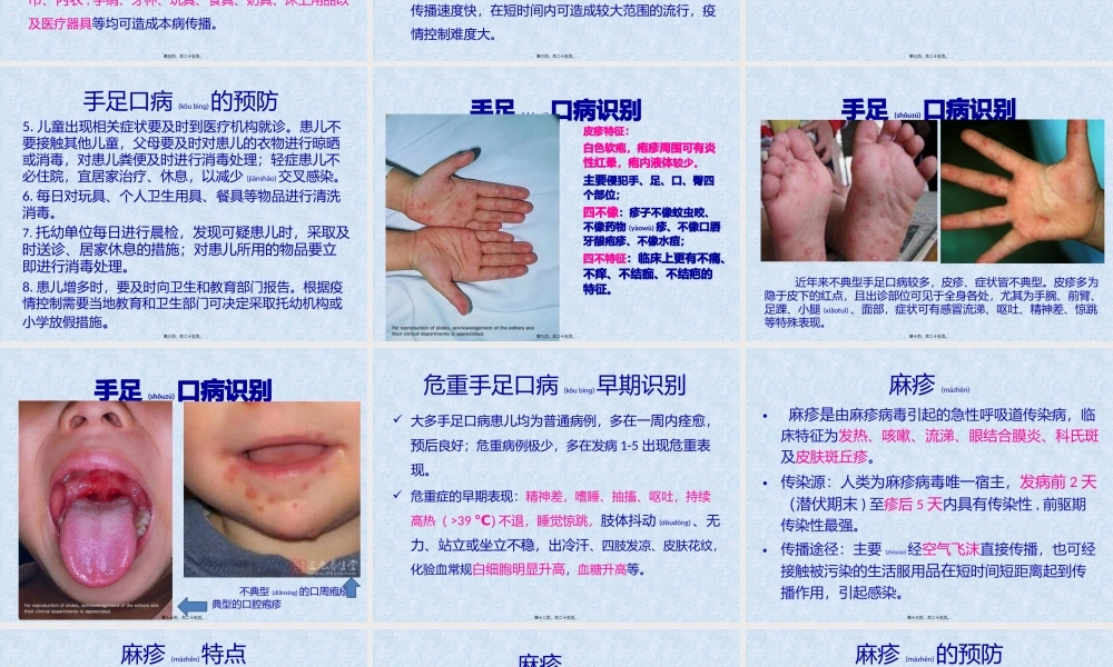 2022年医学专题—儿童常见传染病(1).pptx